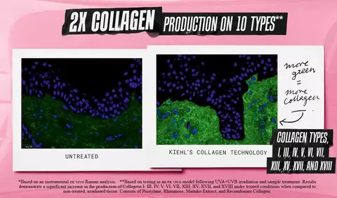 Produccion de Colageno 2X en 10 Tipos
