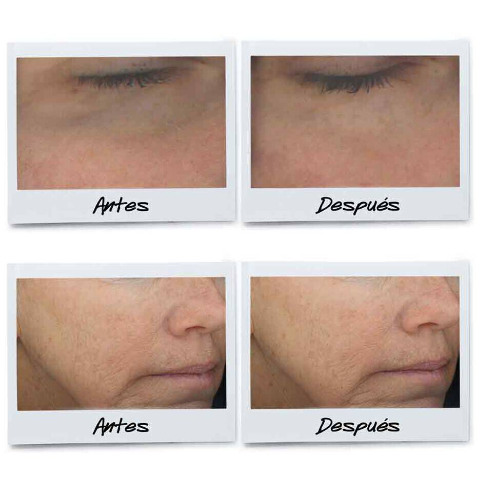 Powerful-Strength Line-Reducing Vitamin C Serum
