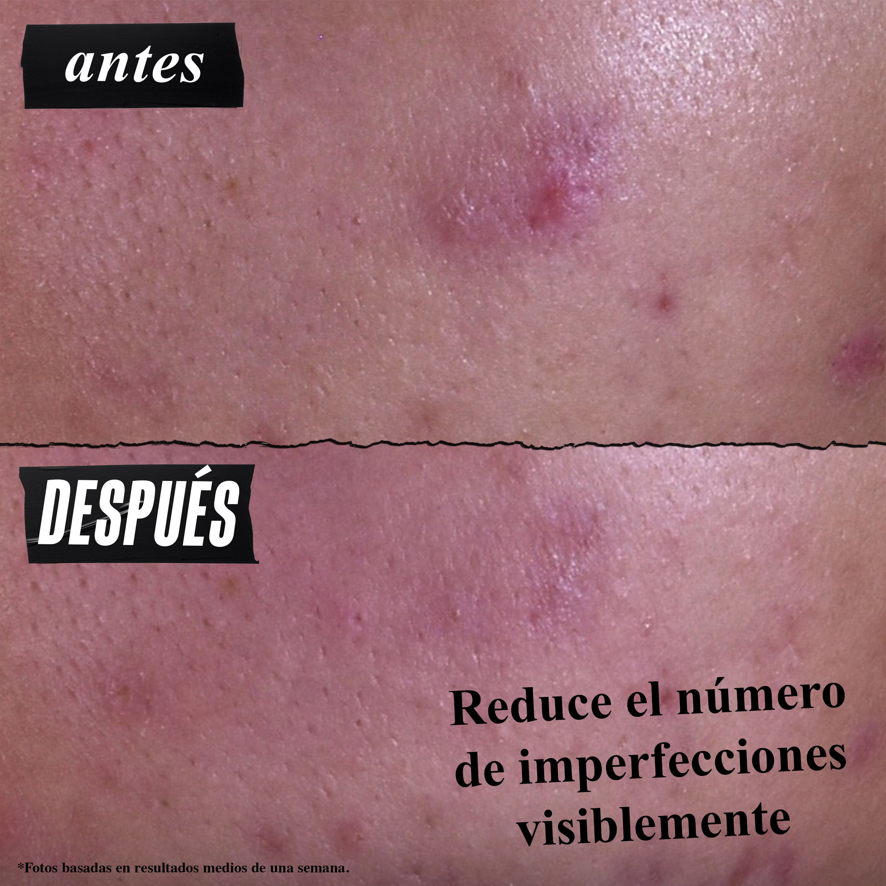 Gently Effective Blemish-Treating Cleansing Paste