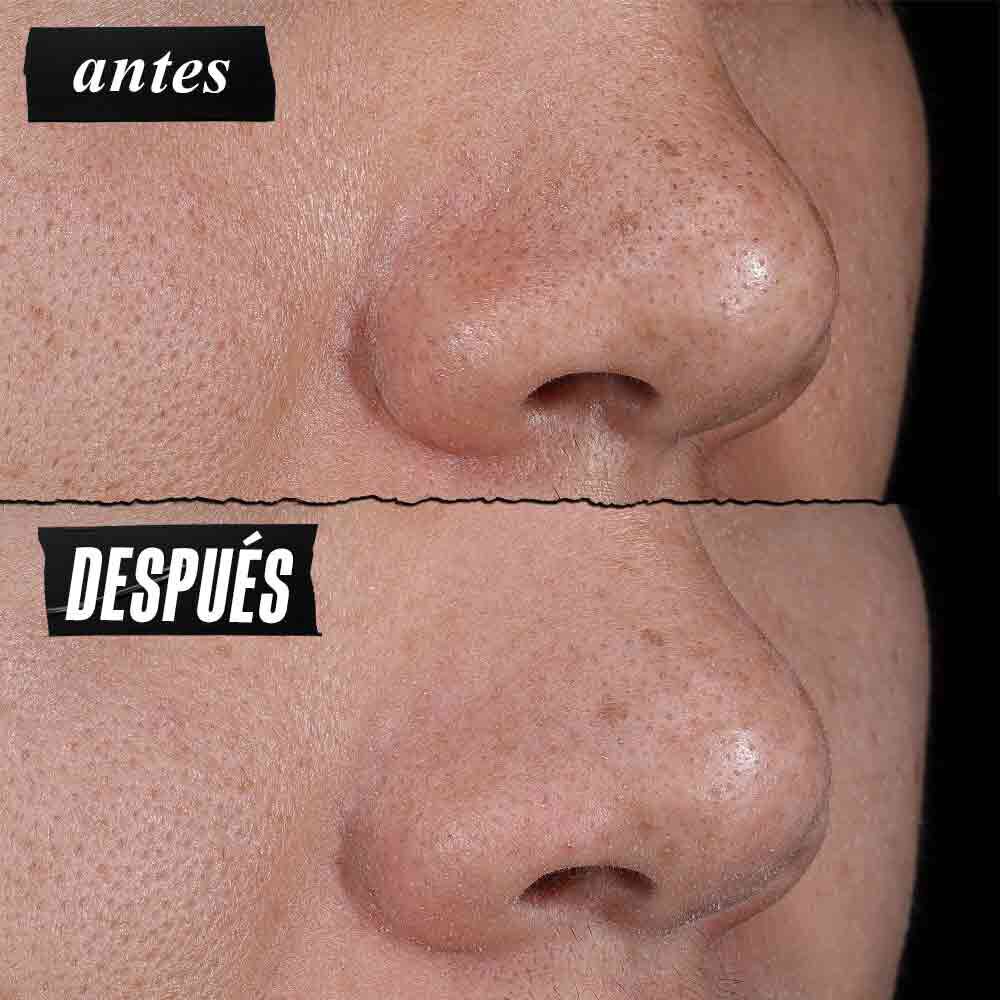 Rare Earth Deep Pore Cleansing Mask